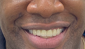 Soft Touch Dental | Extractions, Oral Exams and Dental Anxiety