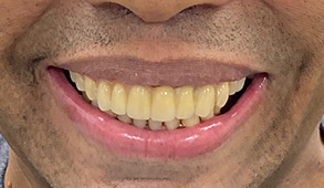 Soft Touch Dental | Oral Exams, Dental Cleanings and Emergency Treatment