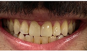 Soft Touch Dental | Teeth Whitening, Emergency Treatment and Cosmetic Smile Makeover