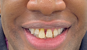 Soft Touch Dental | Cosmetic Dentistry, Sports Mouthguards and Invisalign reg 