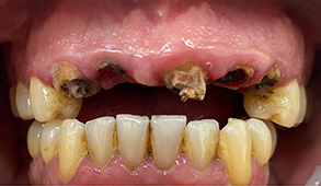 Soft Touch Dental | Oral Exams, Dental Bonding and Emergency Treatment