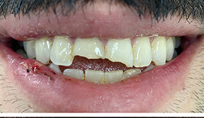 Soft Touch Dental | Dental Anxiety, Cosmetic Smile Makeover and Do I Have Sleep Apnea