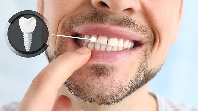 The image shows a man with a toothbrush in his mouth, examining his teeth under a magnifying glass, which is placed over his nose.