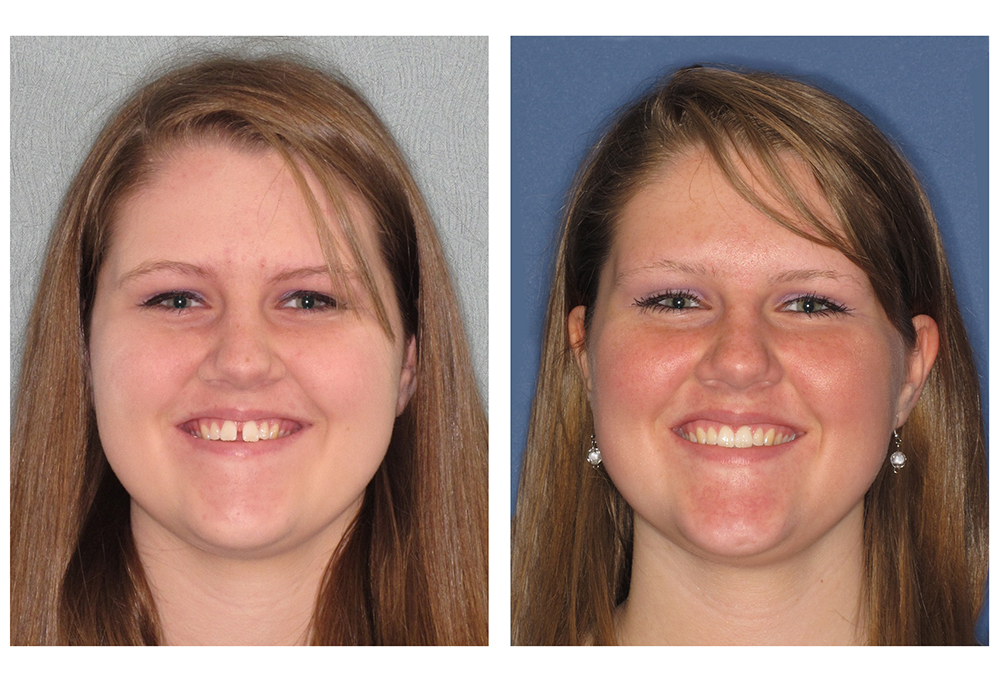 Soft Touch Dental