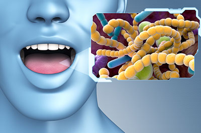 The image shows a 3D rendering of a human face with an open mouth, placed next to a microscopic view of bacteria, suggesting a connection between oral health and bacterial infection.