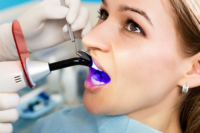 A woman receiving dental treatment with a purple light, wearing a surgical mask and having her mouth open.