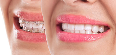 The image shows a close-up of a person s smiling face with pink lipstick, and a second, smaller image within it, also displaying the same smile.