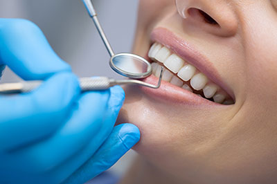 A woman receiving dental care, with her mouth open and a dental professional using a tool on her teeth.