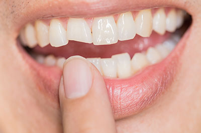 This is an image of a person holding up their finger towards their mouth, which appears to be brushing their teeth. The individual is smiling broadly with their teeth visible, showcasing a clean and healthy oral hygiene routine.