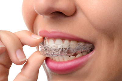 The image shows a person with a full set of clear braces on their teeth, holding a toothpick between their fingers and thumb, focusing intently on the task at hand.