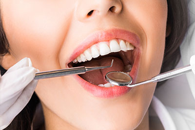 A woman with open mouth is receiving dental care  she has braces on her teeth, and a dental professional is using a drill on her tooth.