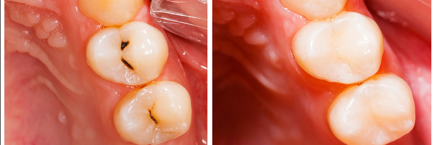 Soft Touch Dental