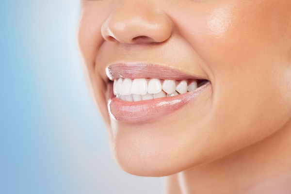 Is Dental Bonding The Right Choice For You?